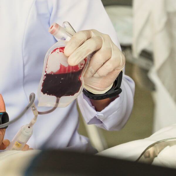 angiologia-cirurgia-vascular (20)
