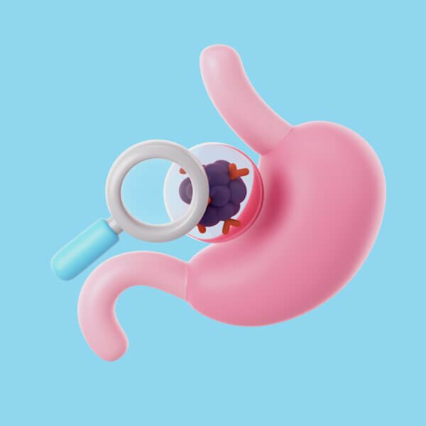 endoscopia (3)