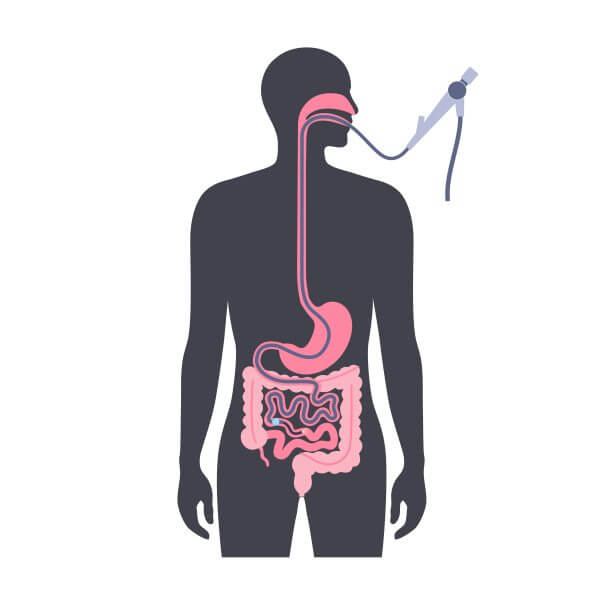 endoscopia (7)
